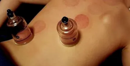 este
