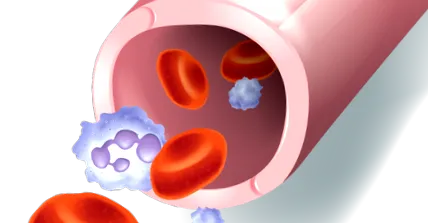 venoase Informații importante