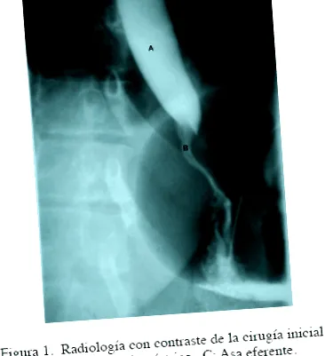 gastrogastricus