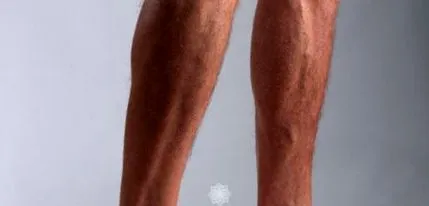 javító