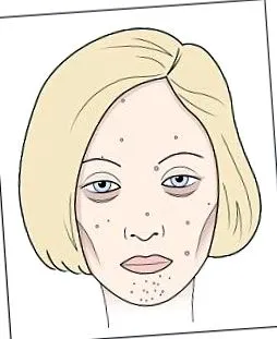 глисти мини
