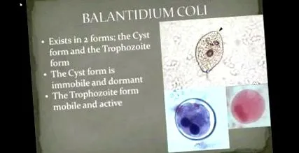 хелминти amoebiasis