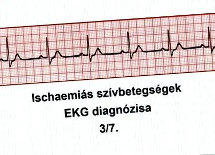 після