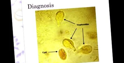срещу лекарства