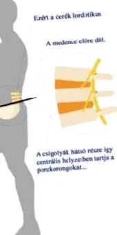 излекуване херния