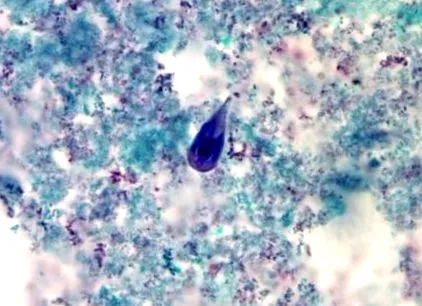 bergen arsak giardia