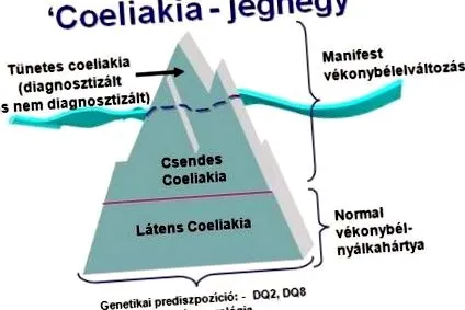асоциация глутен