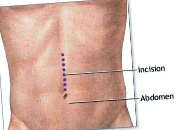 след продължите