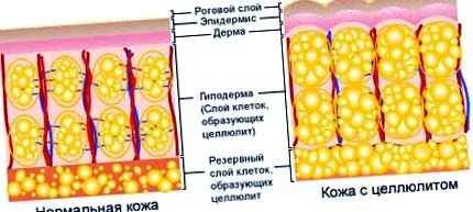 загубите дебелите