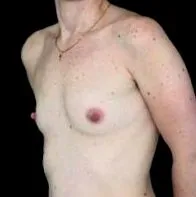 галерия бюста