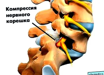 біль ревматоїдний