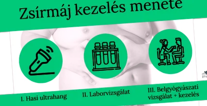 жирова жирова
