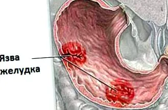 ставите ставите