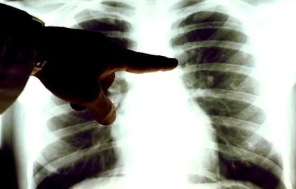 diagnosticul