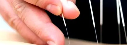 biomed акупунктура