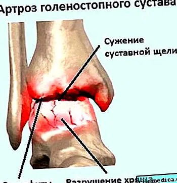 repararea