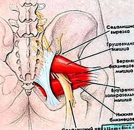тазостегнових остеохондроз