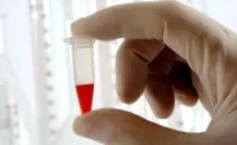 глютену глютену