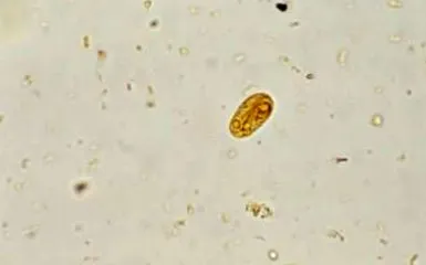 інфекція інфекція