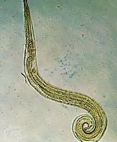 oxiuri dieta