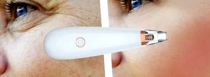 Idealist mini Vibro Idealist