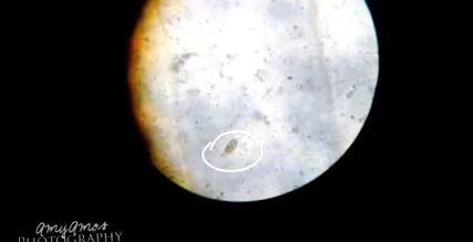 giardia форум