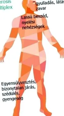 вродена vision