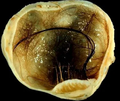 majcyst режим