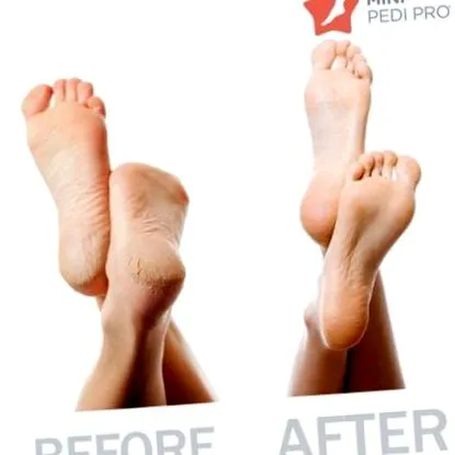 pedi mini