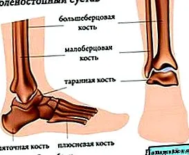 деформуючого артрозу