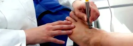 стрели лекува