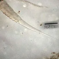 pinworm лечение