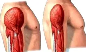 sarcopenia musculare