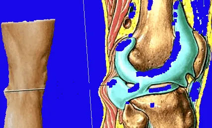 osguda-schlatter юноши