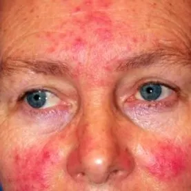dermatica дерматологія
