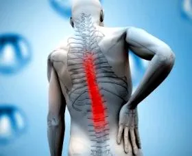 spondylosis spondylarthrosis
