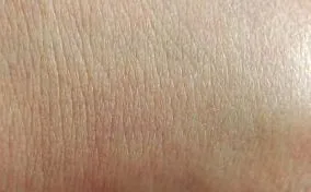 айлънд