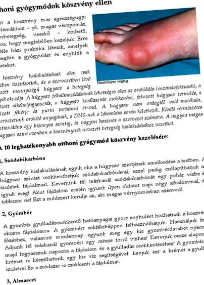 лечение ставите