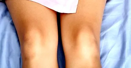 костите Health Femina