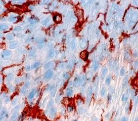pancreatice