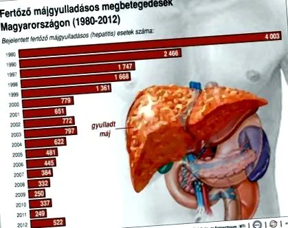 pentru