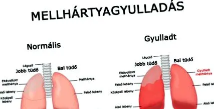симптоми Симптоми лікування