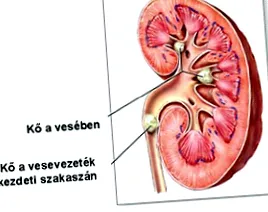 uropatika uropatika