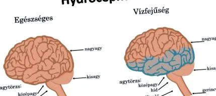 симптоми знаходиться черевній порожнині