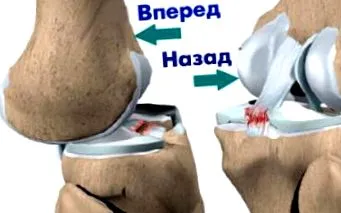 лигамент кръстосан