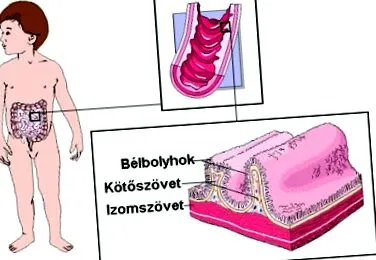 антибіотиків більш важких
