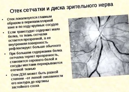 профилактика анкилоза
