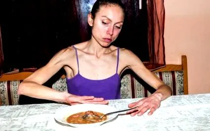 анорексията анорексията