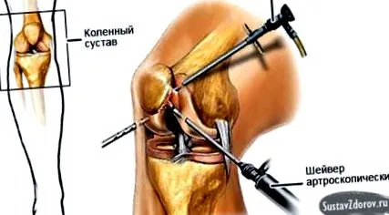 ускладнення проблеми