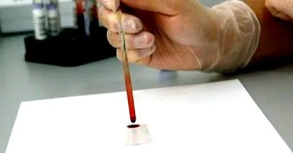 csepp
